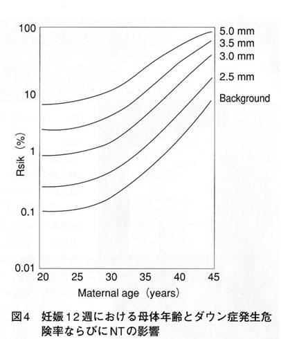 ダウン症,エコー検査,NT,リスク