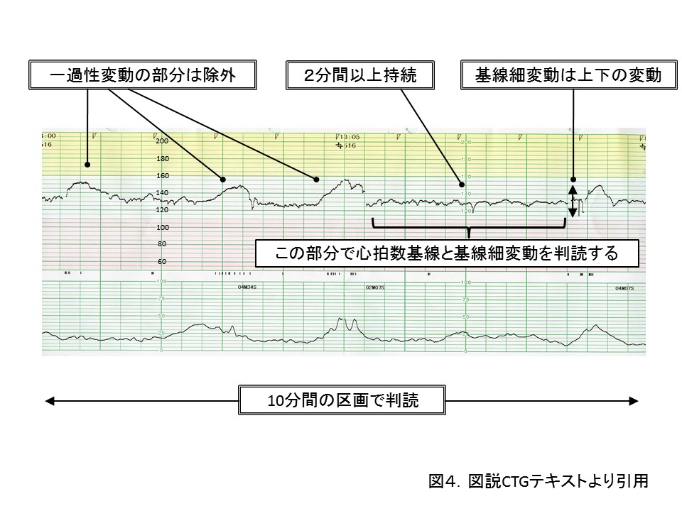 赤ちゃん　心拍モニター