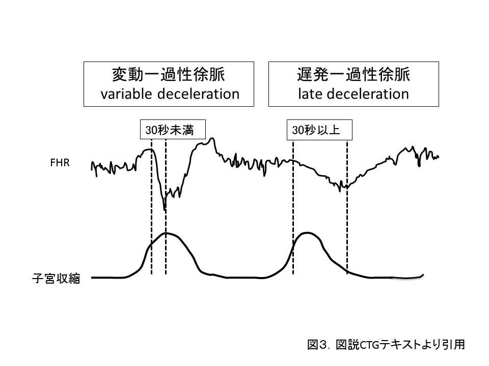 一 過 性 徐 脈 と は