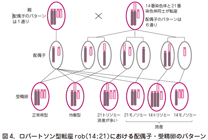 18 トリソミー 原因