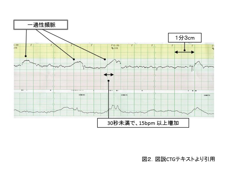 1 分間 脈拍 数