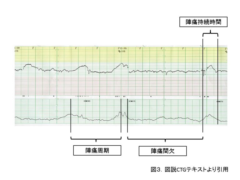 3 スタートアップ３ 胎児が健全である証拠 日本産婦人科医会
