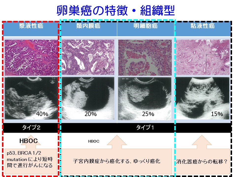 遺伝性乳がん卵巣がん症候群 (HBOC) とは何ですか?