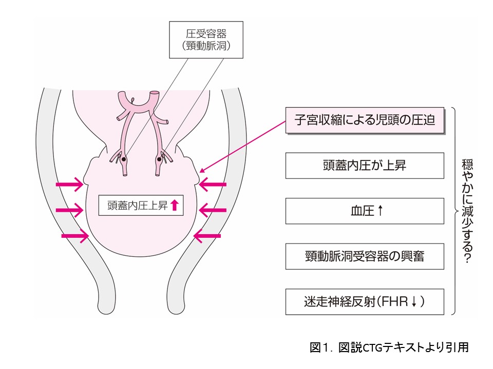 動脈 圧迫 頸 頸動脈狭窄症とは？放置すると危険な理由と治療法について