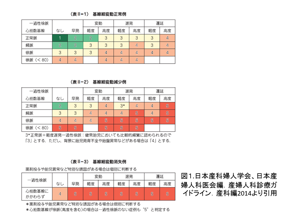 ステップアップ８ 胎児心拍数波形のレベル分類 日本産婦人科医会