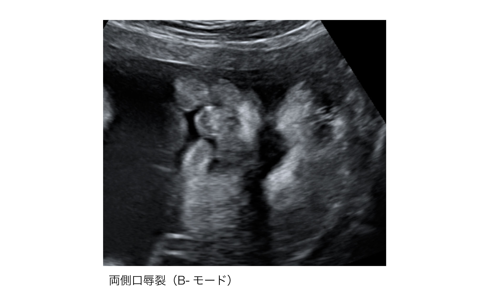 19 胎児の形態異常 頭部 日本産婦人科医会