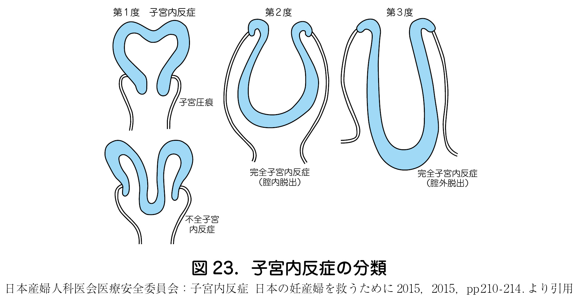 続く 内診 グリグリ 出血