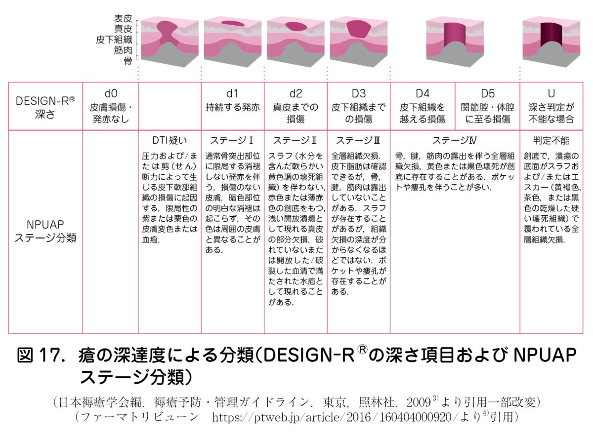 9．褥瘡の予防と管理 – 日本産婦人科医会