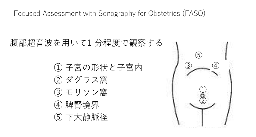 38 産科救急の超音波検査point Of Care Ultrasound Pocus 日本産婦人科医会