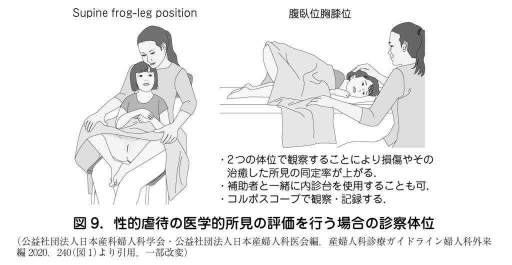 処女膜 小学生 3）刑事裁判を見据えた性的虐待への対応 – 日本産婦人科医会