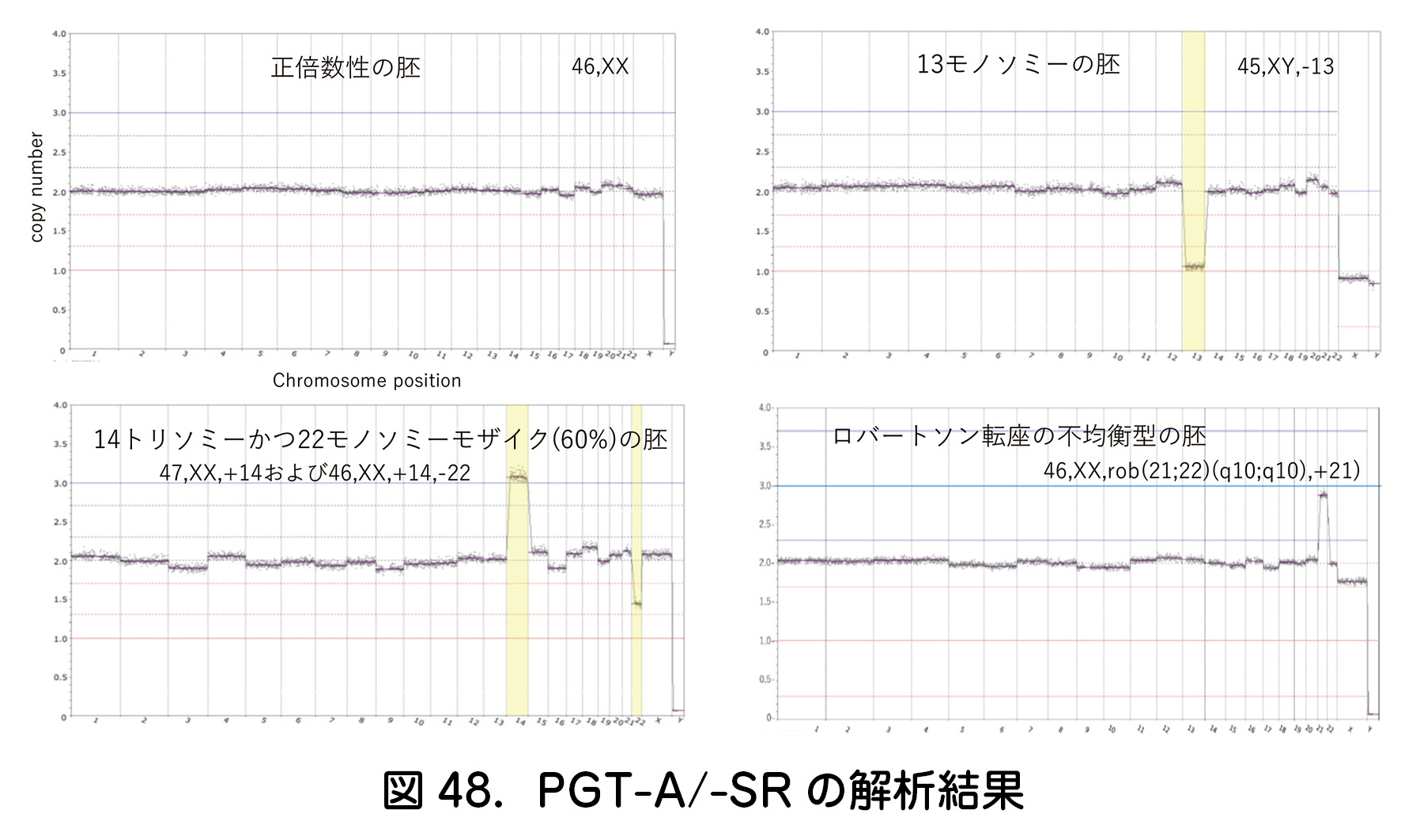 図48．PGT-A/-SRの解析結果
