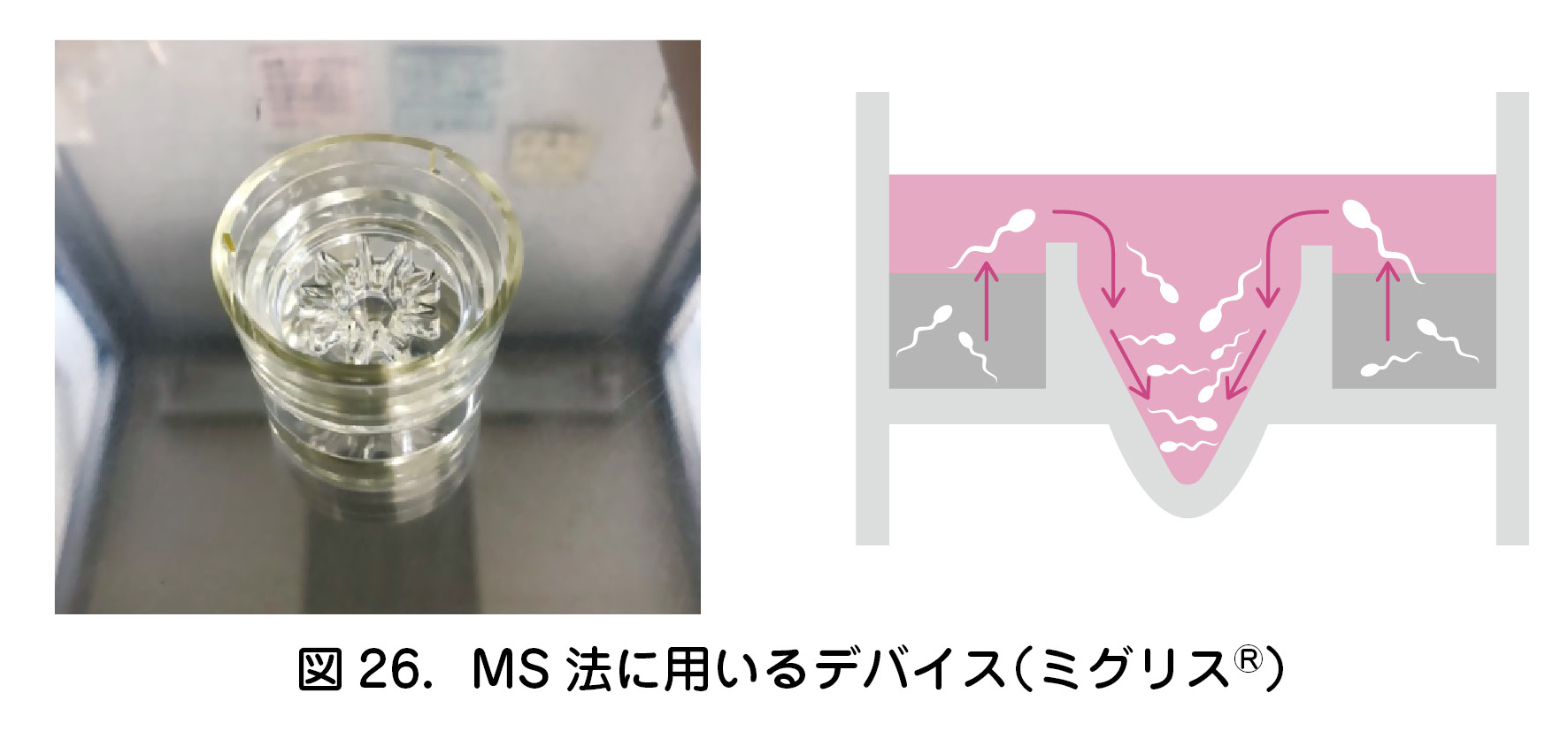 図26．MS法に用いるデバイス（ミグリス®）