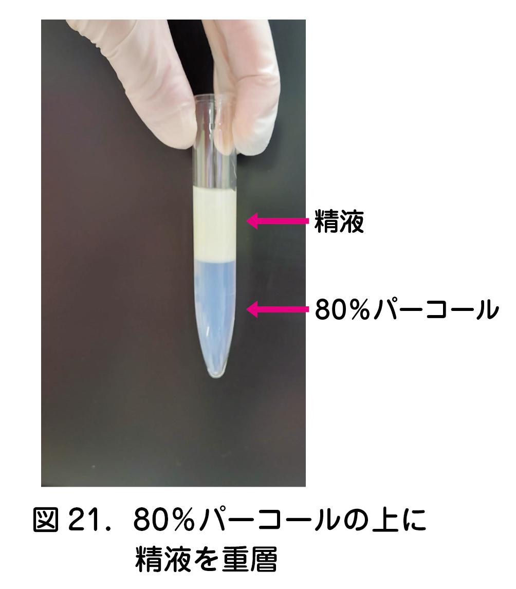 図21．80%パーコールの上に精液を重層