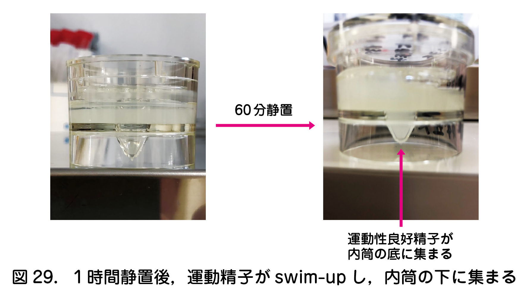 図29．１時間静置後，運動精子がswim-upし，内筒の下に集まる