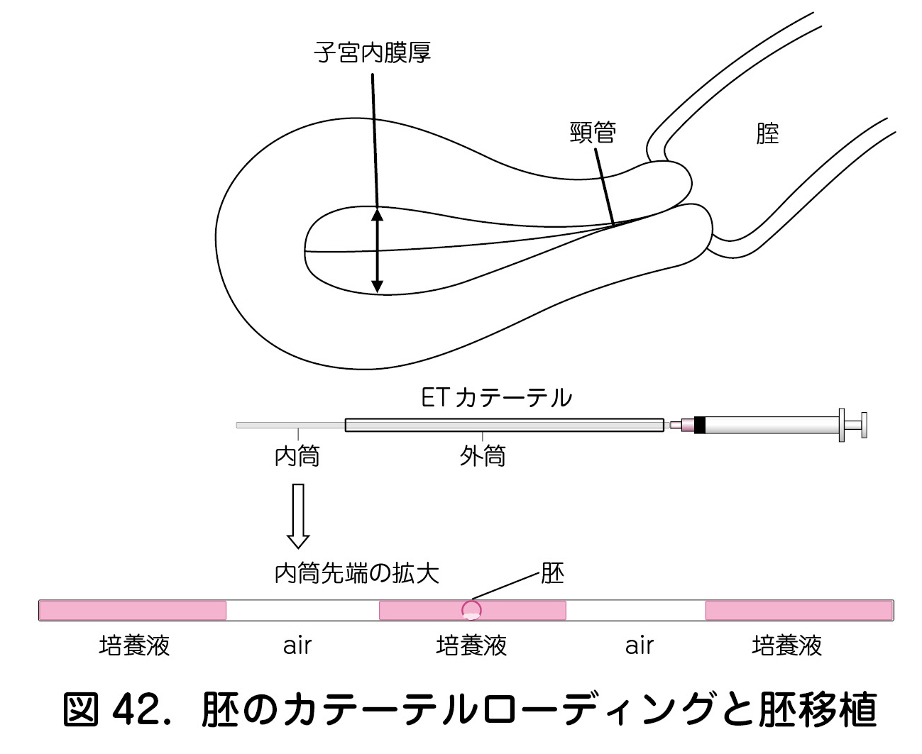 図42．胚のカテーテルローディングと胚移植