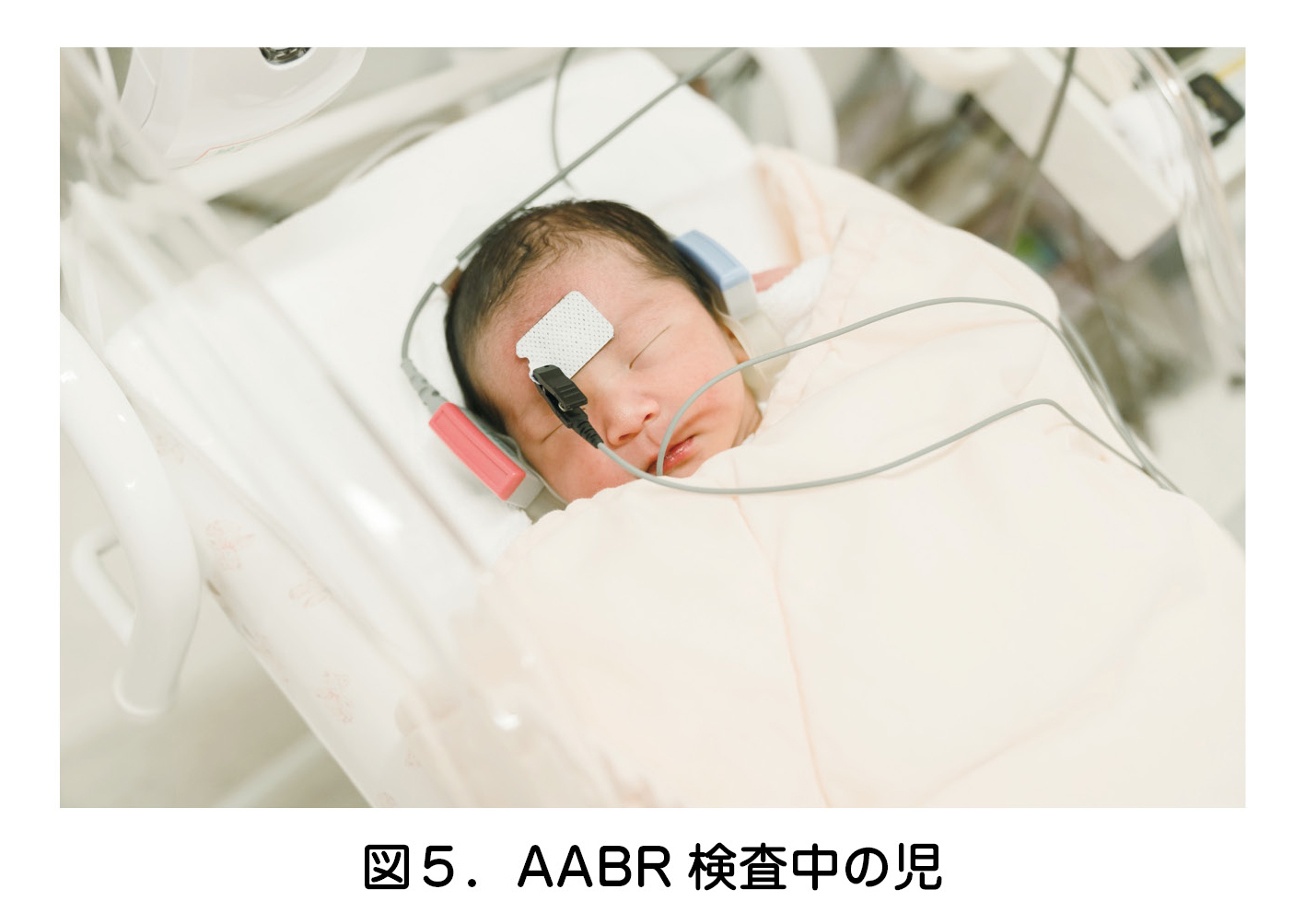 図5.AABR 検査中の児