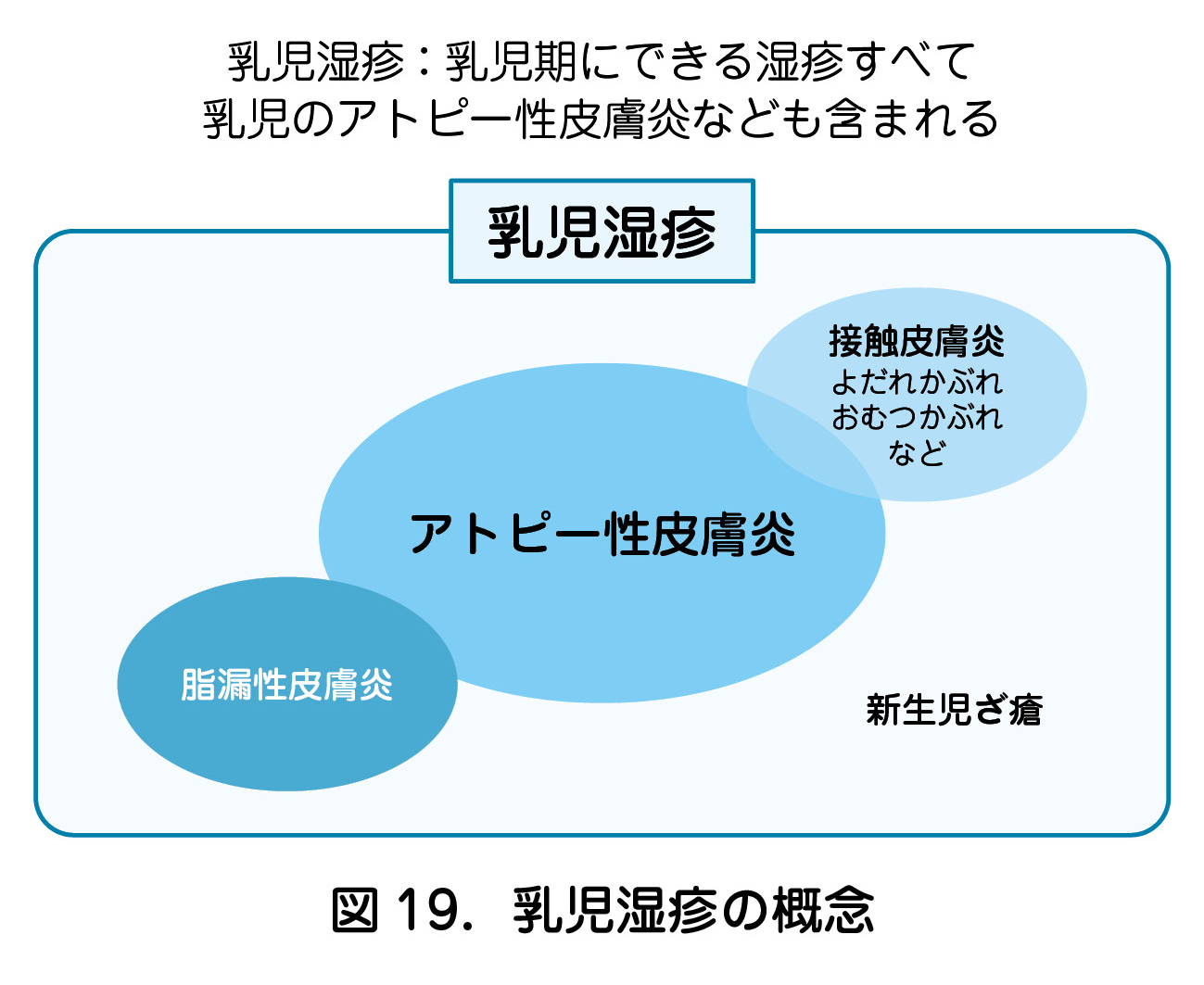 乳児湿疹：乳児期にできる湿疹すべて  乳児のアトピー性皮膚炎なども含まれる  図 19．乳児湿疹の概念