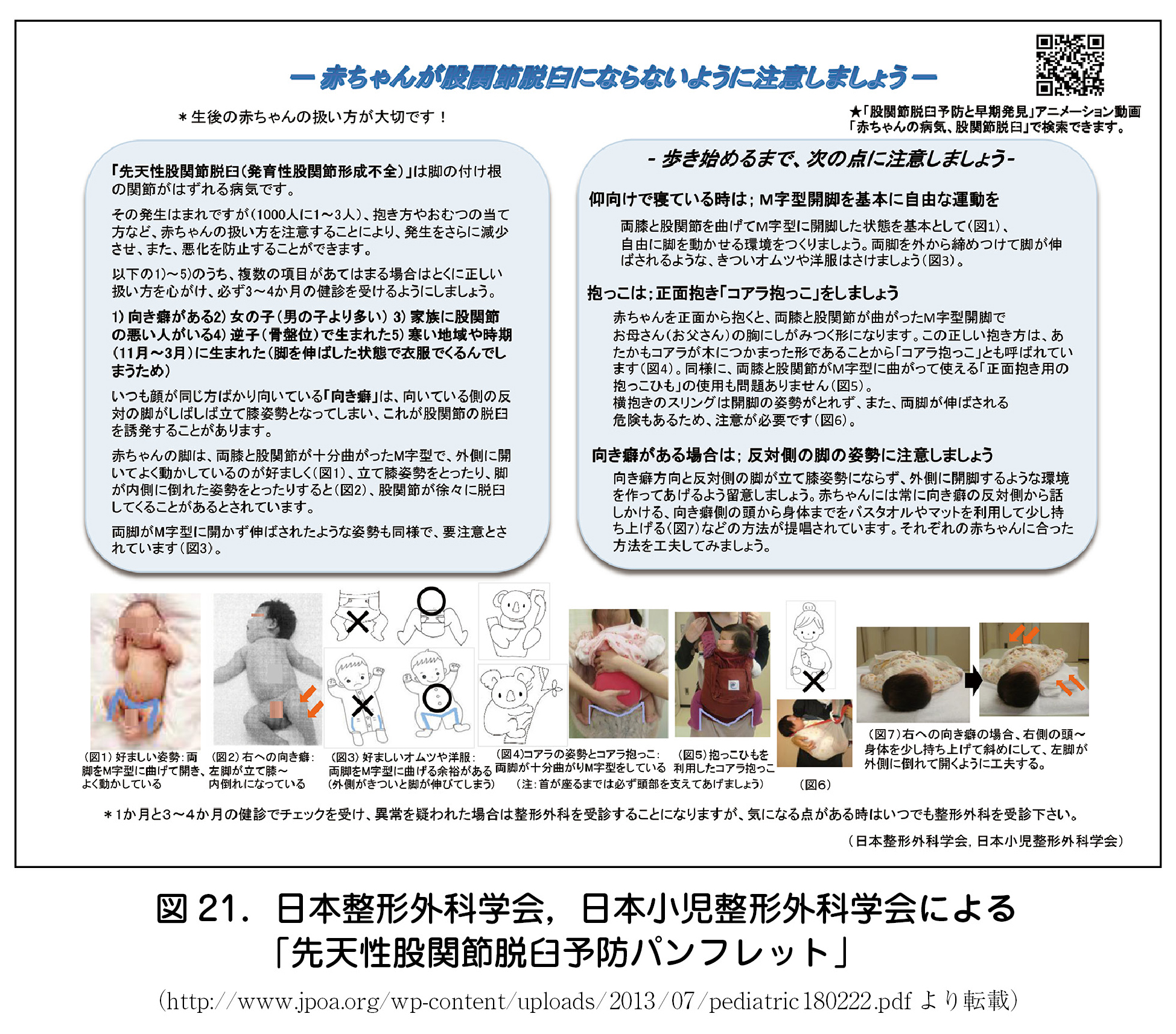 図 21．日本整形外科学会，日本小児整形外科学会による  「先天性股関節脱臼予防パンフレット」  （http://www.jpoa.org/wp-content/uploads/2013/07/pediatric180222.pdf より転載）